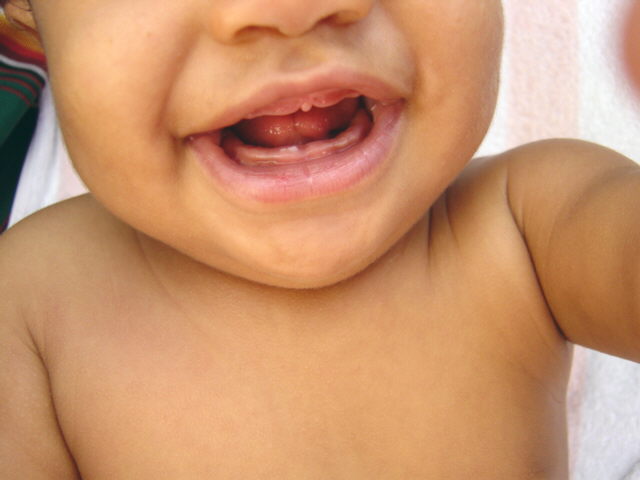Can you see  my first tooth coming in?
